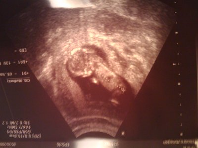 13 weeks and 1 day passed. 26 weekss and 6 days left.